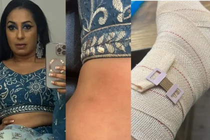 Kashmera Shah's Accident Injured with Multiple Fractures, Blames 'Evil Eye'