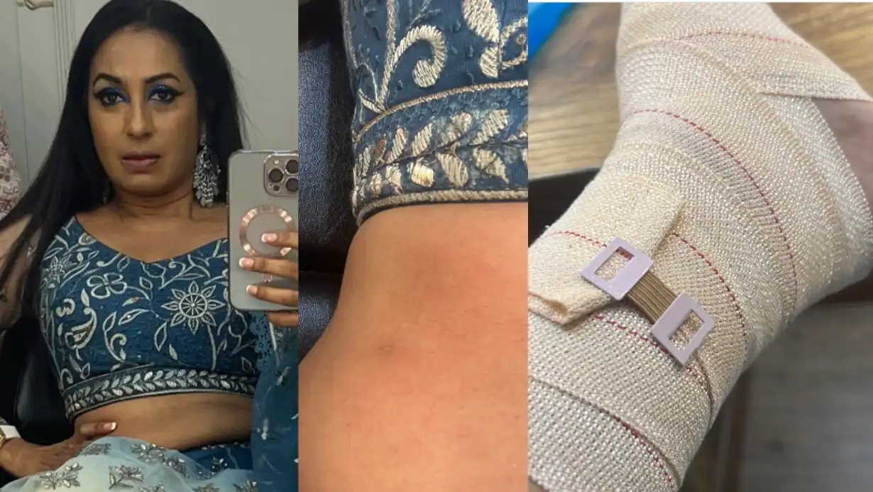 Kashmera Shah's Accident Injured with Multiple Fractures, Blames 'Evil Eye'