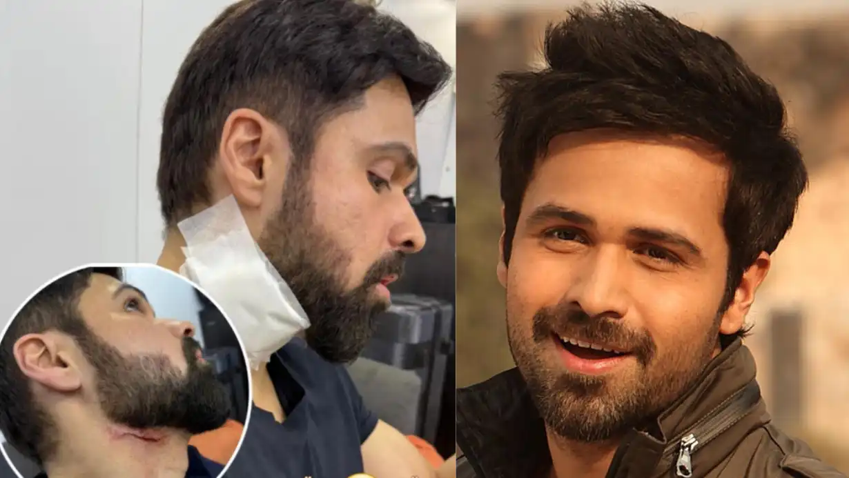 Emraan Hashmi Suffers Serious Injury On The Sets Of ‘godachari 2’