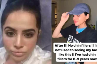 Uorfi Javed's Transformation Unrecognizable After Removing Chin Fillers