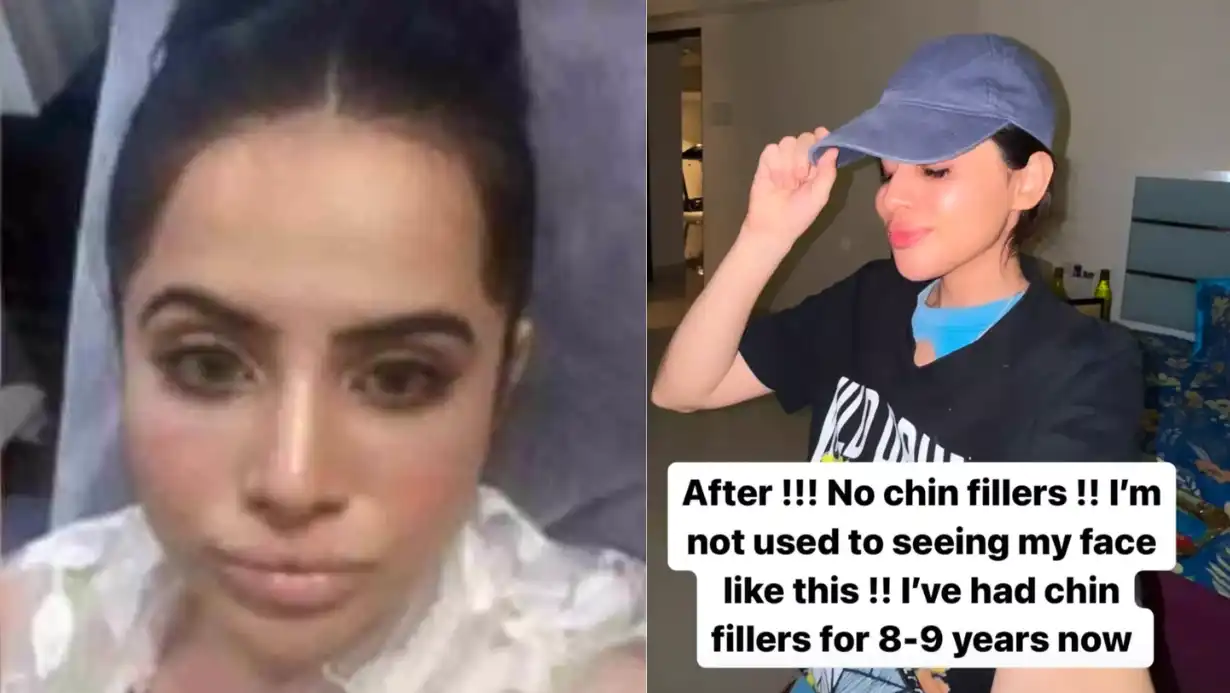 Uorfi Javed's Transformation Unrecognizable After Removing Chin Fillers