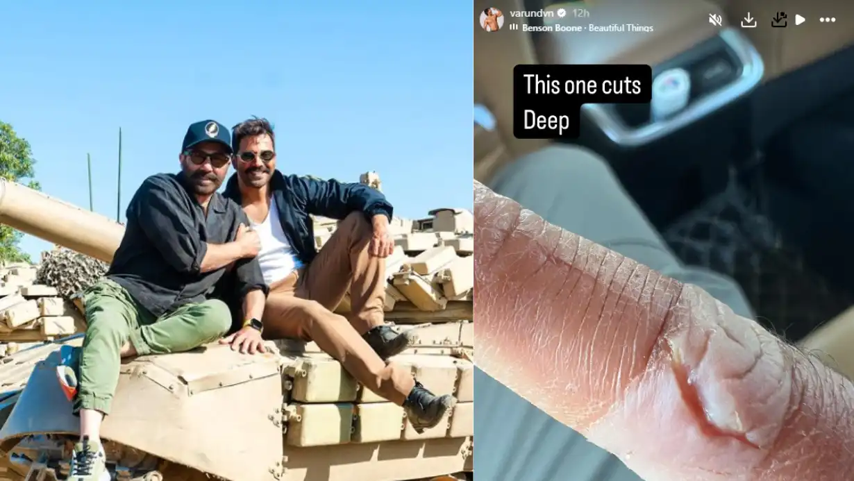 Varun Dhawan Injured On 'border 2' Set, Shares Deep Wound Image